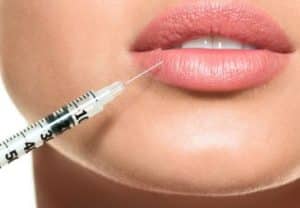 Preenchimento labial